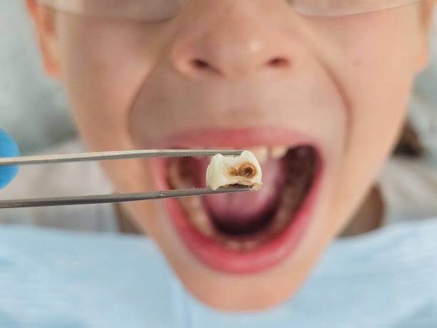 Best Knocked-Out Tooth Emergency  in Mineral Springs, NC