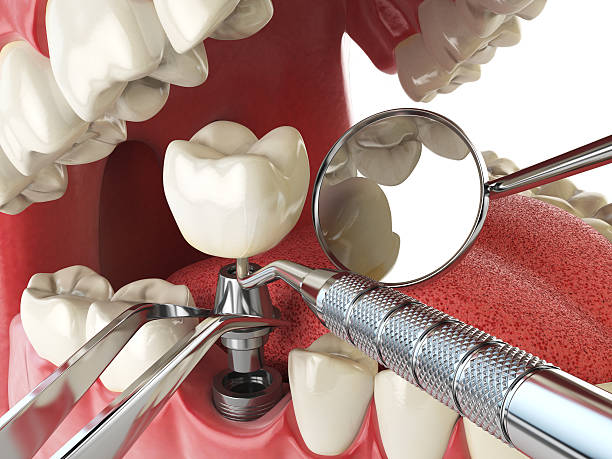 Best Cracked Tooth Emergency Dentist  in Mineral Springs, NC